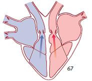 part 2 -Ventricular- systole -atrial diastole.jpg